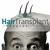 مصحة قبرص لزراعة الشعر