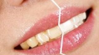 مركز اتش اف لطب الأسنان التجميلي    