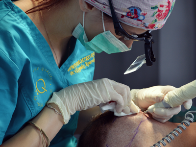 IQ Hair Intensive Quality FUE Hair Transplant, Athens, Greece