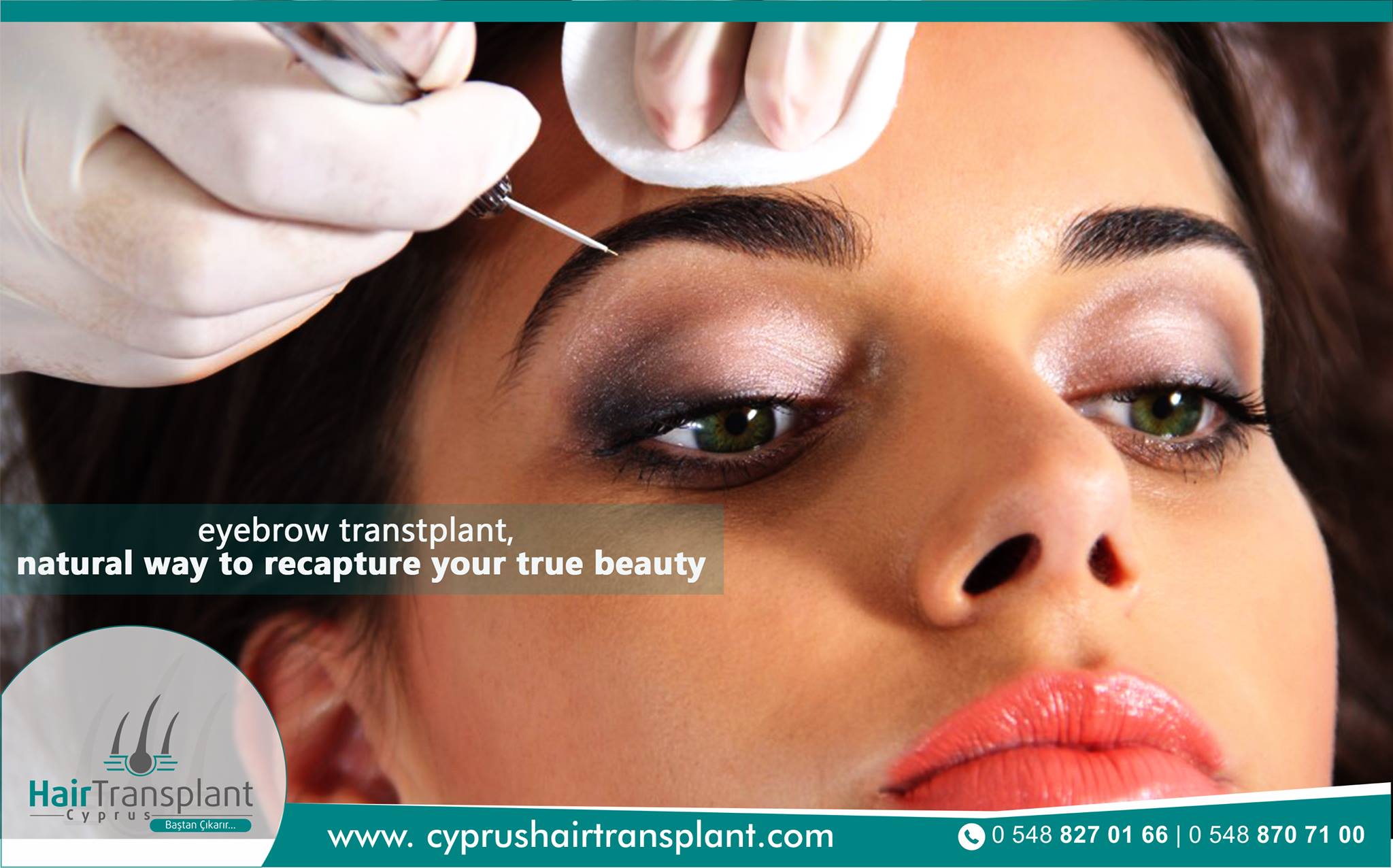 Cyprus Hair Transplant Clinic - Hair Transplant Clinics | Find Hair Loss  Surgeons in Our Exclusive Hair Restoration Network Worldwide