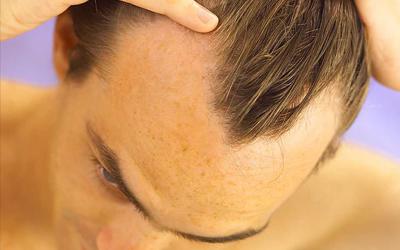 Tunisia Becoming Recognized Leader in Hair Restoration